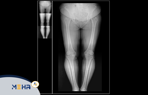 نرم افزار استیچ (Radiology Stitch)