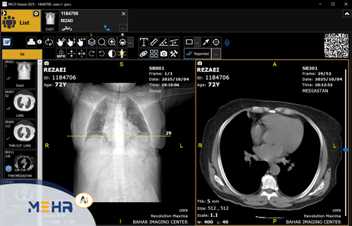 پکس سی تی اسکن (CT Scan PACS)