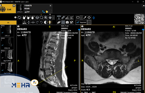 پکس MRI (Magnetic Resonance Imaging PACS)