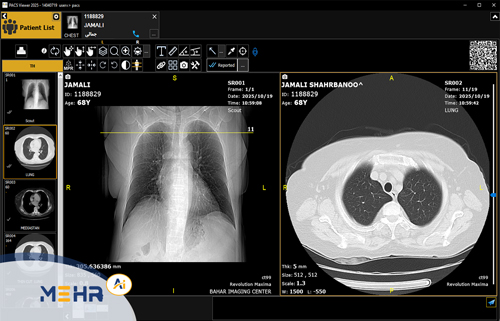 راهنمای جامع سامانه‌های PACS و نرم‌افزارهای تصویربرداری پزشکی مهر