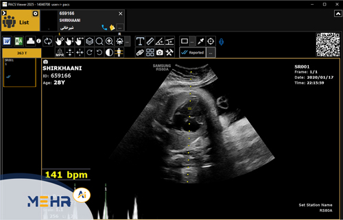 پکس سونوگرافی (ultrasound pacs)